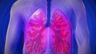 Effective Treatments for Lung Metastases