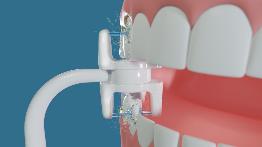 Miracle Smile Magic Flosser